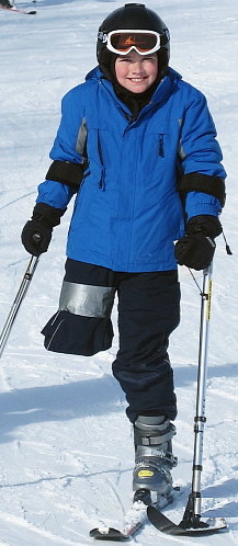Truman skiing on one leg